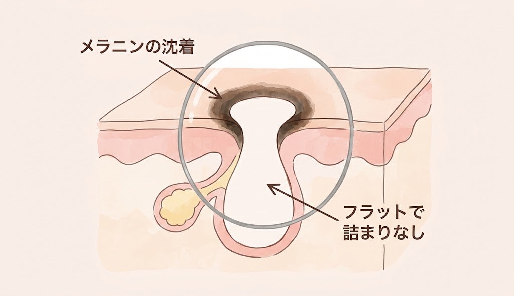 毛穴のふちにメラニンが沈着してリング状に縁取られているイメージ図